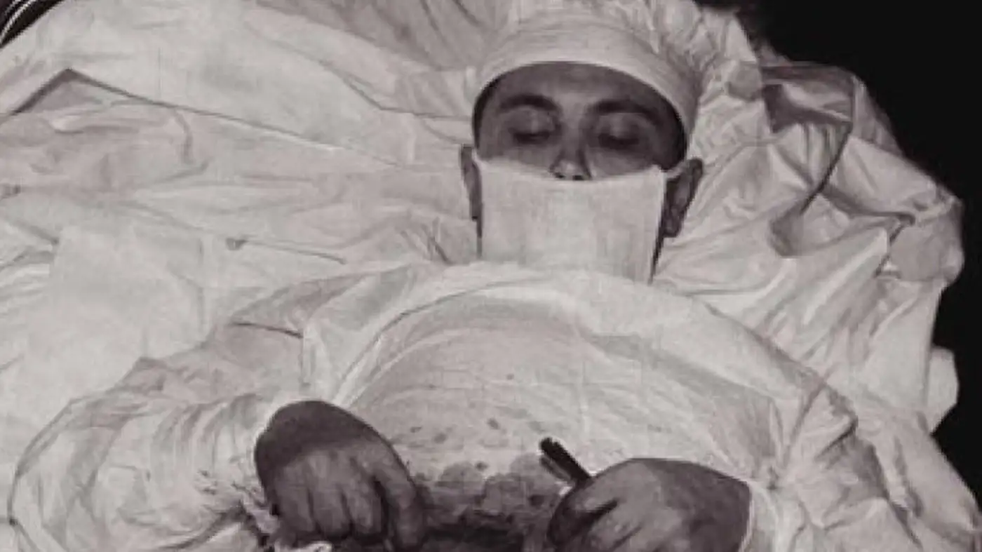 This Doctor Performed Surgery on HIMSELF